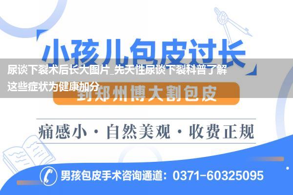 尿谈下裂术后长大图片_先天性尿谈下裂科普了解这些症状为健康加分